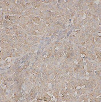 Complement C8A Antibody - BSA Free
