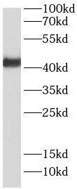RNF34 Antibody - BSA Free