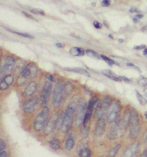 PTPN3 Antibody - BSA Free