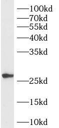 RAB33B Antibody - BSA Free