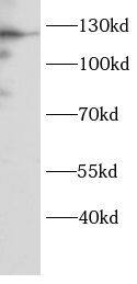 DNA2 Antibody - BSA Free