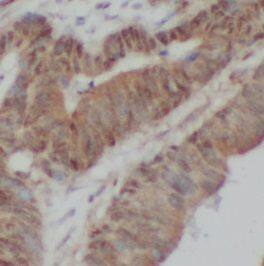 ABCA4 Antibody - BSA Free