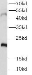 PTGER4/EP4 Antibody - BSA Free