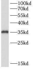 Thymidine Kinase 2 Antibody - BSA Free