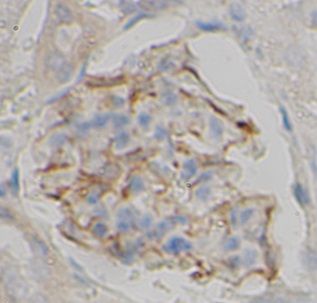 Thymidine Kinase 2 Antibody - BSA Free