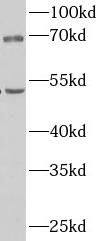 CPN1 Antibody - BSA Free