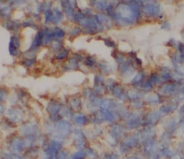 CPN1 Antibody - BSA Free