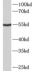 METTL4 Antibody - BSA Free