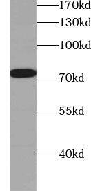 ZXDC Antibody - BSA Free