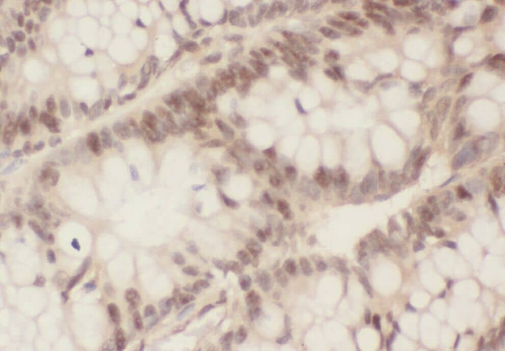 ZWILCH Antibody - BSA Free