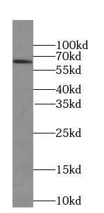 SLC30A7 Antibody - BSA Free