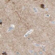 SLC30A3 Antibody - BSA Free