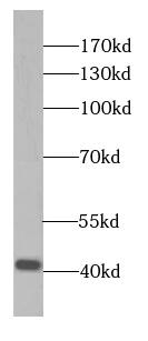 SLC30A3 Antibody - BSA Free