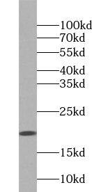 ZNHIT1 Antibody - BSA Free
