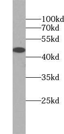 ZNF763 Antibody - BSA Free