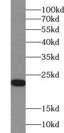 ZNF747 Antibody - BSA Free