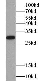ZNF740 Antibody - BSA Free