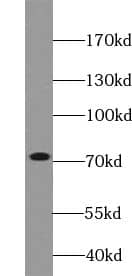 ZNF695 Antibody - BSA Free
