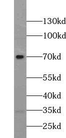 ZNF658 Antibody - BSA Free