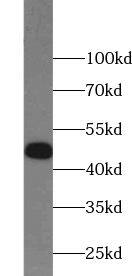 ZNF645 Antibody - BSA Free