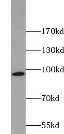 ZNF606 Antibody - BSA Free