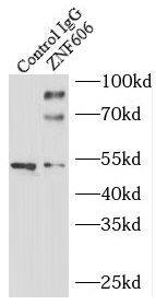 ZNF606 Antibody - BSA Free