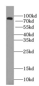 ZNF600 Antibody - BSA Free