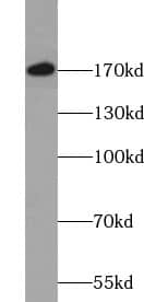 TULP4 Antibody - BSA Free