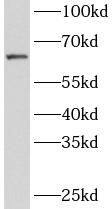 ZNF571 Antibody - BSA Free