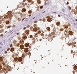 ZNF571 Antibody - BSA Free