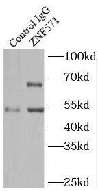 ZNF571 Antibody - BSA Free