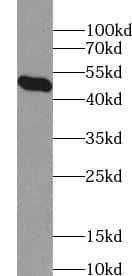 ZNF557 Antibody - BSA Free