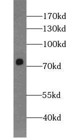 ZNF549 Antibody - BSA Free