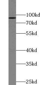 ZNF509 Antibody - BSA Free