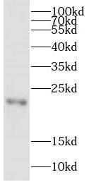 CPLX4 Antibody - BSA Free