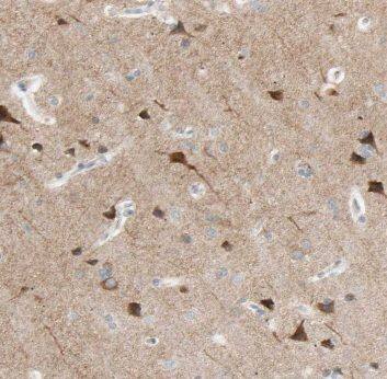 CPLX4 Antibody - BSA Free