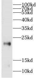CPLX3 Antibody - BSA Free