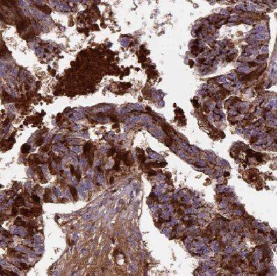 COX7A2L Antibody - BSA Free