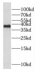 COX18 Antibody - BSA Free
