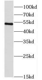 Coronin-2B Antibody - BSA Free