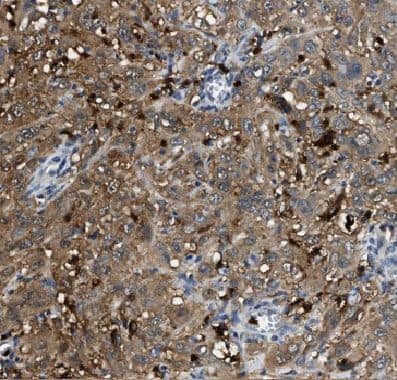 Coronin 3 Antibody - BSA Free