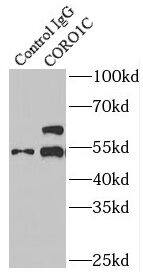 Coronin 3 Antibody - BSA Free