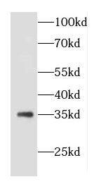 COQ5 Antibody - BSA Free