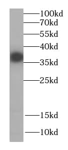 CPOX Antibody - BSA Free