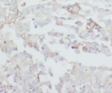 CPOX Antibody - BSA Free