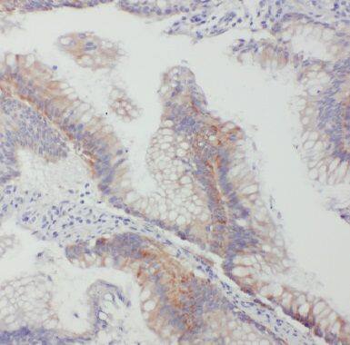 Connexin 26/GJB2 Antibody - BSA Free