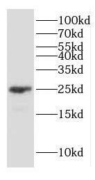 Connexin 26/GJB2 Antibody - BSA Free