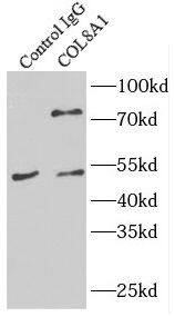 Collagen VIII alpha 1 Antibody - BSA Free
