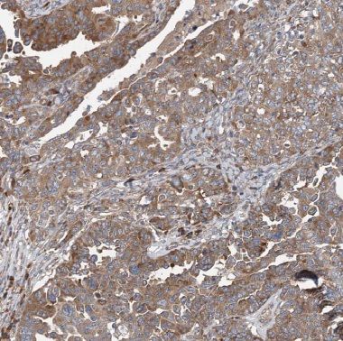 COG1 Antibody - BSA Free