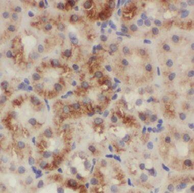 CNRIP1 Antibody - BSA Free